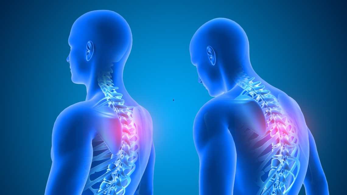 5 Everyday Habits That Might Be Hurting Your Posture (and How to Fix Them)